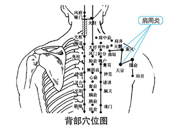 龍馬治療儀 龍馬治療儀
